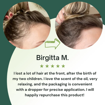 Hair Growth Serum (60ml)