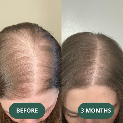 Hair Growth Serum (60ml)