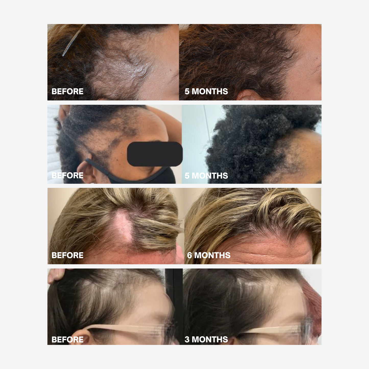 Hair Growth Serum (60ml)