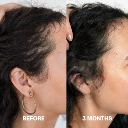 Hair Growth Serum (60ml)