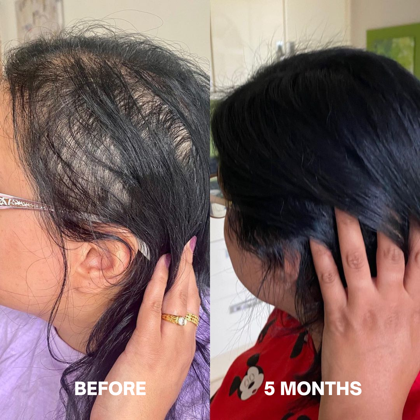 Hair Growth Serum (60ml)