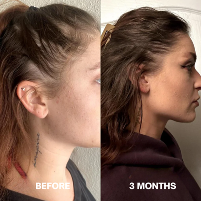 Hair Growth Serum (60ml)