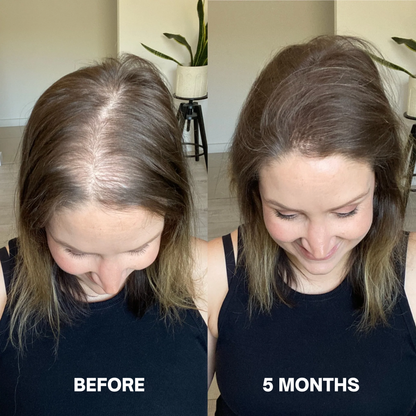 Hair Growth Serum (60ml)